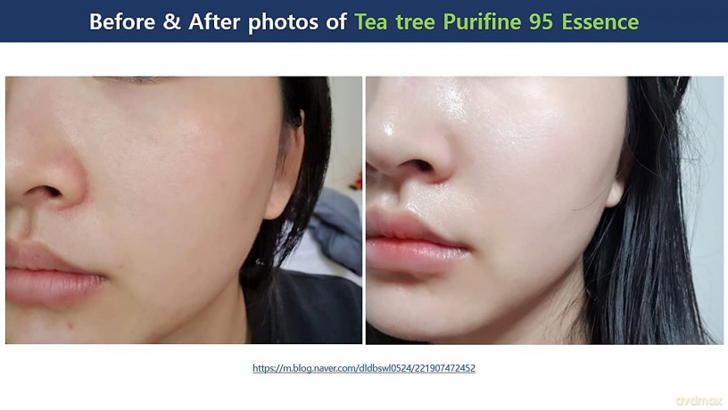 Essence for problematic skin Tea Tree Purifine 95 Essence 50 ml