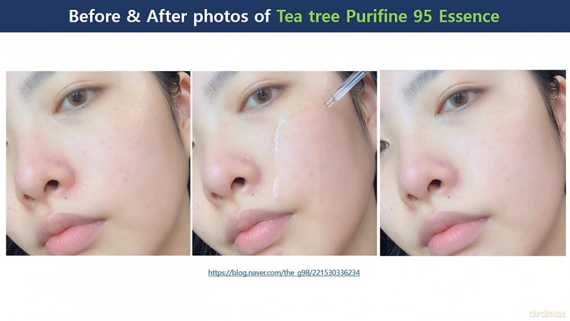 Essence for problematic skin Tea Tree Purifine 95 Essence 50 ml