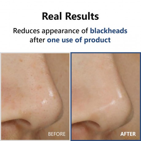 Exfoliating serum Hyper Acid4 Serum 20 ml