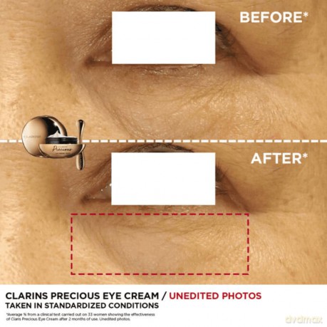 Eye cream with collagen Precious Eye Cream 15 ml
