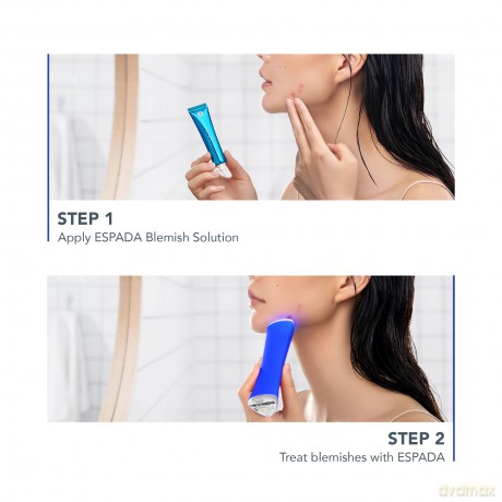FOREO ESPADA 2 30-Second Blue LED Acne Treatment - Variant: Cobalt Blue