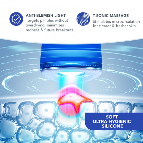 FOREO ESPADA 2 30-Second Blue LED Acne Treatment - Variant: Cobalt Blue