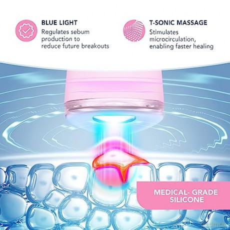 FOREO ESPADA 2 30-Second Blue LED Acne Treatment - Variant: Pearl Pink
