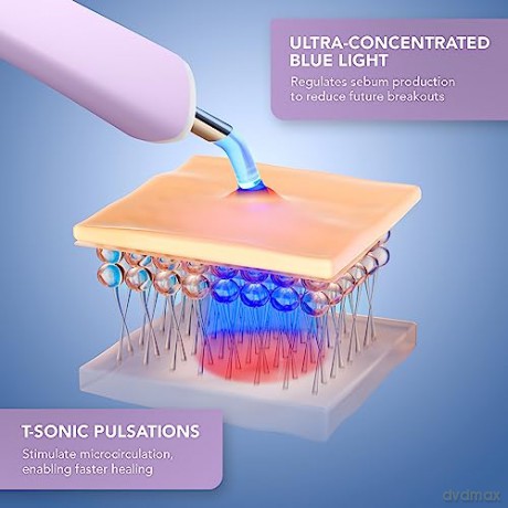 FOREO ESPADA 2 Plus Precisely Targeted Acne Treatment with Blue LED Light - Variant: Lavender