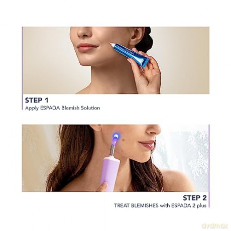 FOREO ESPADA 2 Plus Precisely Targeted Acne Treatment with Blue LED Light - Variant: Lavender