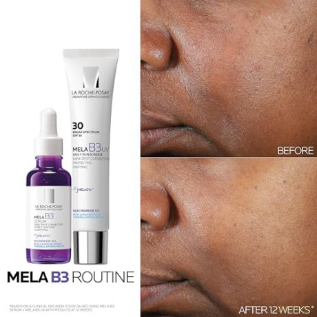 Intensive serum against dark spots Mela B3 Intensive Anti-Dark Spots Serum 30 ml