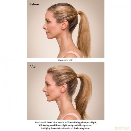 Invati Ultra Advanced Light Hair Volumizing Conditioner Thickening Conditioner - Volume: 200 ml