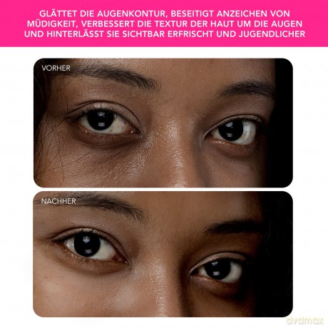 IRIS 2 Brightening Eye Massager - Variant: Fuchsia