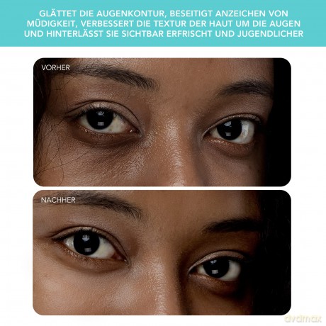 IRIS 2 Brightening Eye Massager - Variant: Mint