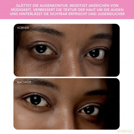 IRIS 2 Brightening Eye Massager - Variant: Pearl Pink