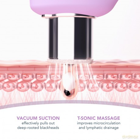 KIWI Derma Microdermabrasion device for cleansing and renewing the skin