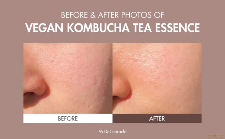 Moisturizing skin essence Vegan Kombucha Tea Essence 150 ml