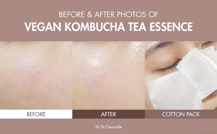 Moisturizing skin essence Vegan Kombucha Tea Essence 150 ml