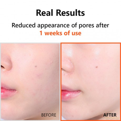 Multifunctional skin serum Hyper Niacinamide 20 Serum 20 ml