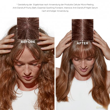 Peeling for sensitive scalp Symbiose Micro-Exfoliating Cellular Treatment - Volume: 200 ml