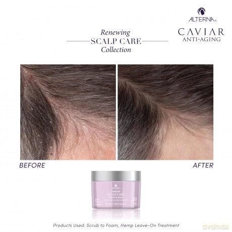 Peeling shampoo Renewing Scalp Care Scrub To Foam 177 ml