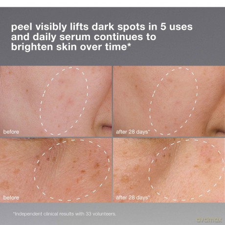 PowerBright Dark Spot System Hyperpigmentation Care Gift Set