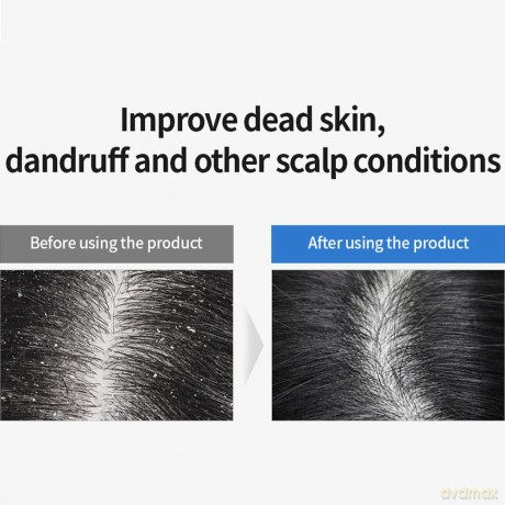 Shampoo with probiotics for hair volume 5 Probiotics Perfect Volume Shampoo - Volume: 150 ml