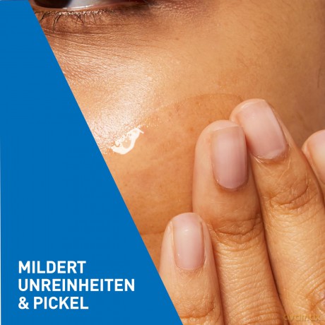 Skin gel against skin imperfections Blemish Control Gel 40 ml