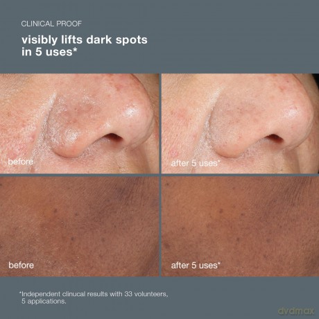 Skin peeling against hyperpigmentation and spots PowerBright Dark Spot Peel 50 ml