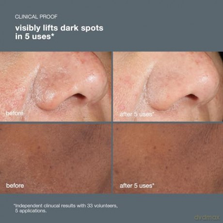 Skin peeling against hyperpigmentation and spots PowerBright Dark Spot Peel 50 ml