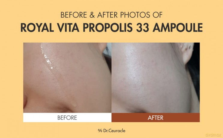 Skin serum Royal Vita Propolis 33 Ampoule 30 ml