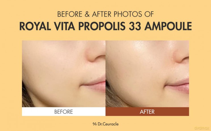 Skin serum Royal Vita Propolis 33 Ampoule 30 ml