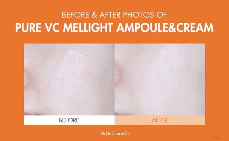 Skin serum with vitamin C Pure VC Mellight Ampoule - Volume: 4 x 8 ml