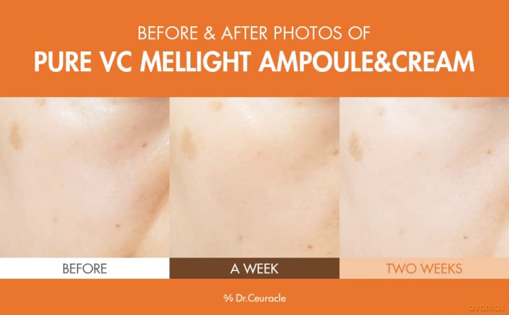 Skin serum with vitamin C Pure VC Mellight Ampoule - Volume: 4 x 8 ml
