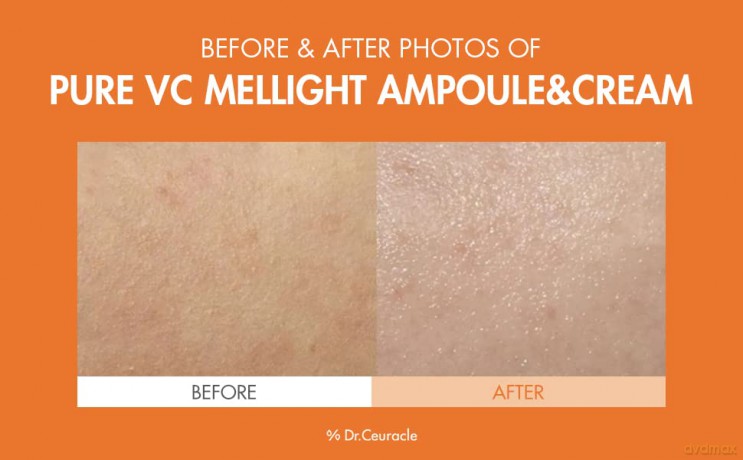Skin serum with vitamin C Pure VC Mellight Ampoule - Volume: 4 x 8 ml