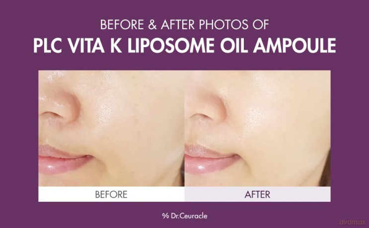 Skin serum with vitamin K PLC Vita Liposome Oil Ampoule 50 ml
