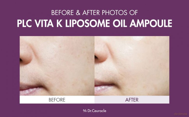 Skin serum with vitamin K PLC Vita Liposome Oil Ampoule 50 ml