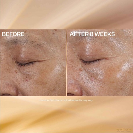 Smoothing eye cream Vitamin C Eye Cream 15 ml