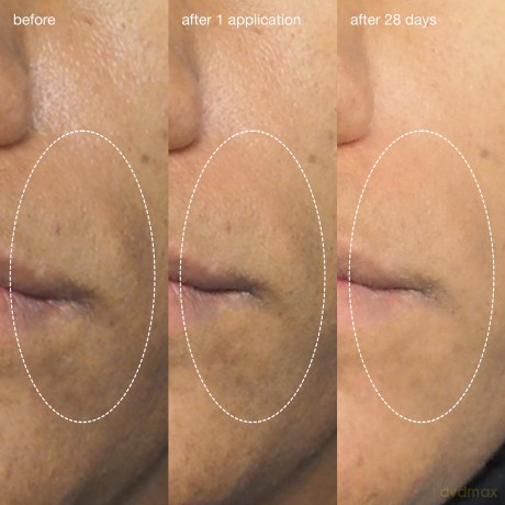 Smoothing facial peeling Liquid Peelfoliant 59 ml