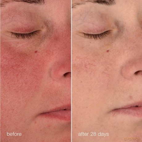Soothing cream for sensitive skin Stabilizing Repair Cream 50 ml