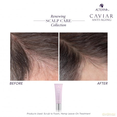 Soothing treatment for dry scalp Renewing Scalp Care Hemp Leave-On Treatment 74 ml