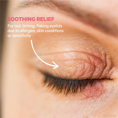Topialyse Soothing Cream for Irritated Eyelids 15 ml