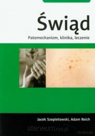 Świąd. Patomechanizm, klinika, leczenie [KSIĄŻKA]