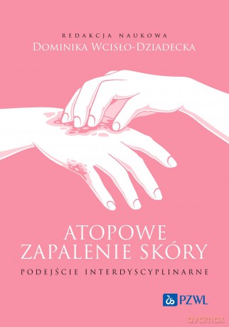 Atopowe zapalenie skóry. Podejście interdyscyplinarne - Dominika Wcisło-Dziadecka [KSIĄŻKA]
