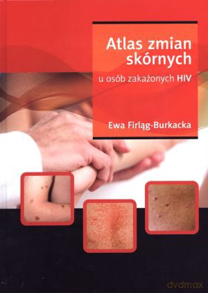 Atlas zmian skórnych u osób zakażonych HIV - Ewa Firląg-Burkacka [KSIĄŻKA]