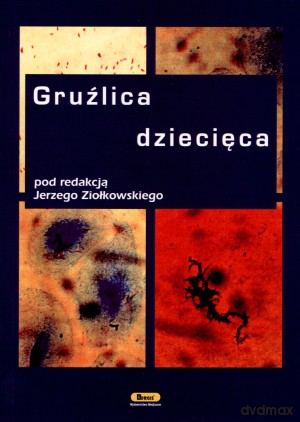 Gruźlica dziecięca - Jerzy Ziołkowski (red.) [KSIĄŻKA]