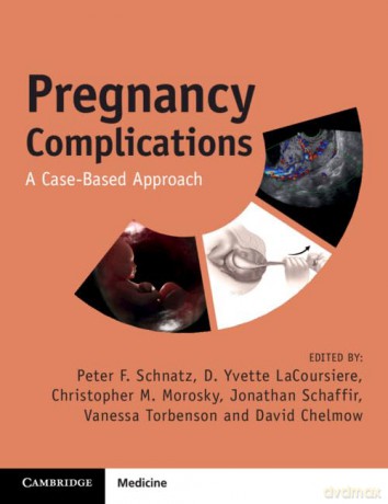 Pregnancy Complications: A Case-Based Approach - Peter F. Schnatz [KSIĄŻKA]