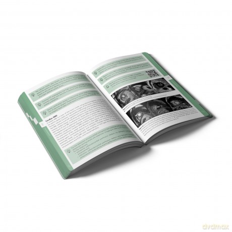 Pocket Cardiology and Vascular Medicine - Veronique Goudberg BSc [KSIĄŻKA]