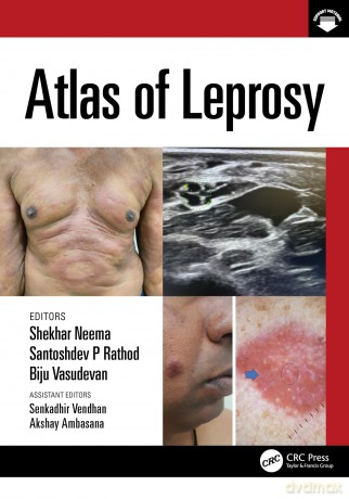 Atlas of Leprosy - Shekhar Neema [KSIĄŻKA]
