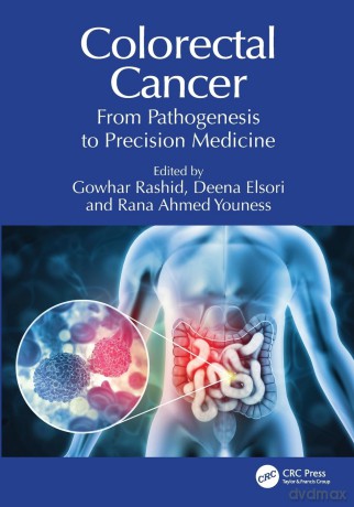 Colorectal Cancer: From Pathogenesis to Precision Medicine - Gowhar Rashid [KSIĄŻKA]
