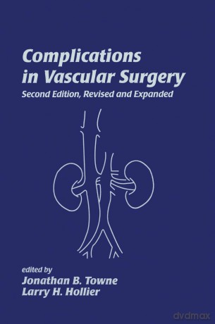 Complications in Vascular Surgery (No Series) - Jonathan B. Towne [KSIĄŻKA]