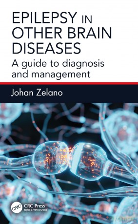 Epilepsy in Other Brain Diseases: A Guide to Diagnosis and Management - Johan Zelano [KSIĄŻKA]