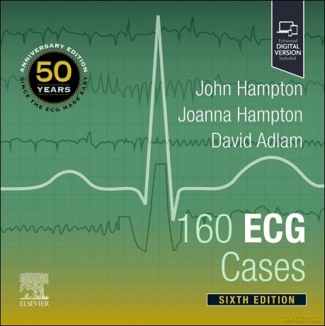 160 ECG Cases - John Hampton DM MA DPhil FRCP FFPM FESC [KSIĄŻKA]