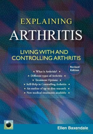 An Emerald Guide to Explaining Arthritis: Living with and controlling Arthritis - Ellen Baxendale [KSIĄŻKA]