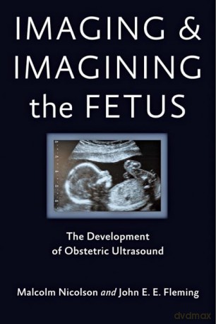 Imaging and Imagining the Fetus - The Development of Obstetric Ultrasound - Malcolm Nicolson [KSIĄŻKA]